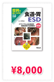 食道・胃ESD改訂版〜ITナイフによる部位別・難易度別の治療戦略